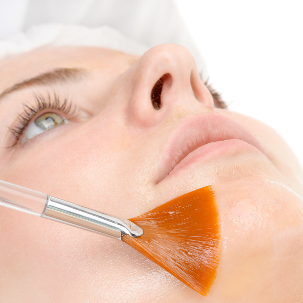 peeling-viso-chirugo-plastico-roma peeling-viso-chirugo-plastico-roma