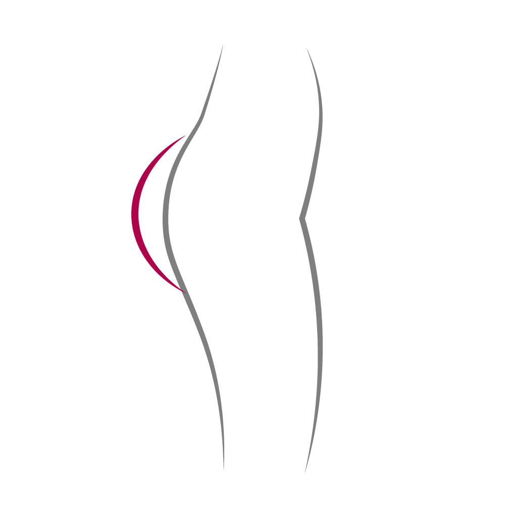 icone-sedere-protesi-glutei